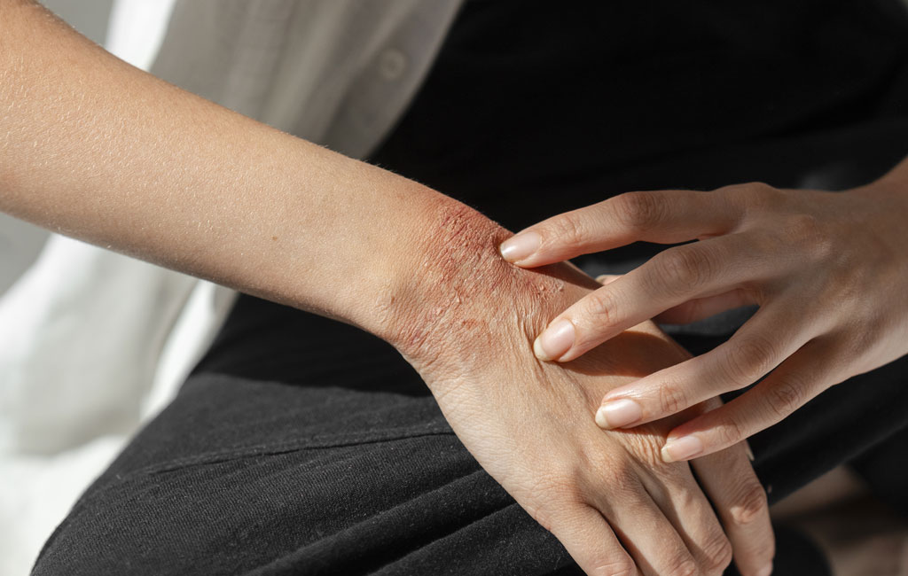 A multidisciplinary team of inflammatory myopathy experts, including basic scientists and epidemiologists conducting translational and clinical research. A multidisciplinary team of inflammatory myopathy experts, including basic scientists and epidemiologists conducting translational and clinical research.